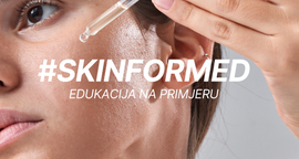 #SKINFORMED / Hiperpigmentacija na osjetljivoj koži